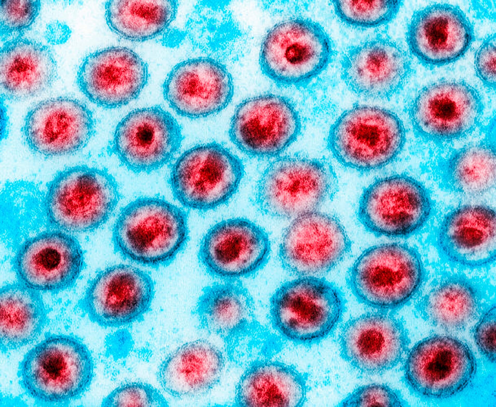 A highly magnified image showing red and blue circular structures resembling viral particles against a light blue background. The image likely represents a scientific depiction of a virus or microscopic biological sample, emphasizing the vibrant color contrast and intricate details.